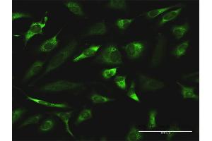 Immunofluorescence of monoclonal antibody to RGN on HeLa cell.