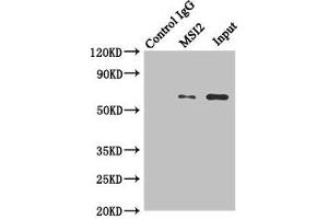 Immunoprecipitating MKS1 in Hela whole cell lysate Lane 1: Rabbit control IgG instead of (1 μg) instead of ABIN7159091 in Hela whole cell lysate. (MKS1 Antikörper  (AA 150-300))