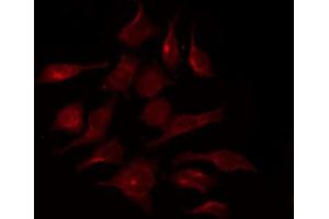 ABIN6267370 staining HepG2 by IF/ICC. (FGFR1 Antikörper  (pTyr154))