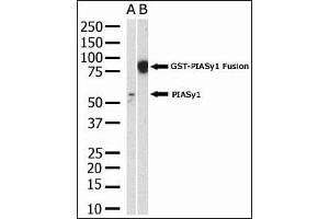 PIAS4 Antikörper  (N-Term)
