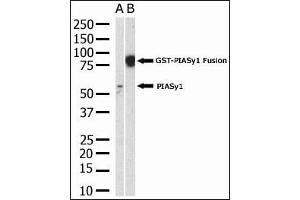 The anti-PIASy polyclonal antibody (ABIN388061 and ABIN2845720) is used in Western blot to detect PIASy in HL-60 cell lysate. (PIAS4 Antikörper  (N-Term))
