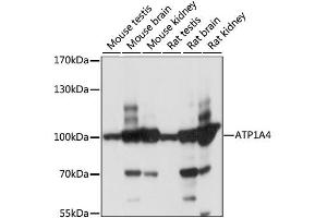Western blot analysis of extracts of various cell lines, using ATP1A4 antibody (ABIN6292469) at 1:1000 dilution. (ATP1A4 Antikörper)