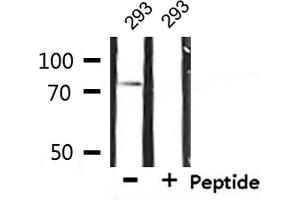 Western blot analysis of extracts from 293, using IL-2Rbeta/CD122 Antibody. (IL2 Receptor beta Antikörper  (Internal Region))