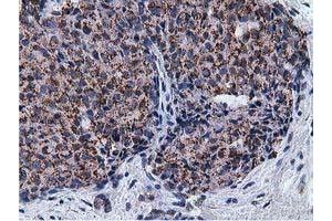 Immunohistochemical staining of paraffin-embedded Human liver tissue using anti-NT5DC1 mouse monoclonal antibody. (NT5DC1 Antikörper)