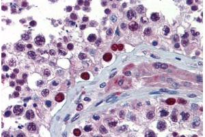 Human Testis (formalin-fixed, paraffin-embedded) stained with NFX1 antibody ABIN462262 followed by biotinylated goat anti-rabbit IgG secondary antibody ABIN481713, alkaline phosphatase-streptavidin and chromogen. (NFX1 Antikörper  (C-Term))