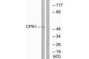 Western blot analysis of extracts from RAW264. (CPN1 Antikörper  (C-Term))