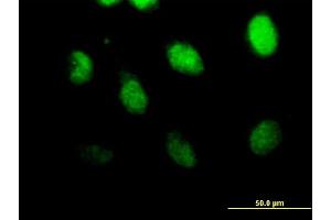Immunofluorescence of purified MaxPab antibody to CSPG6 on HeLa cell. (SMC3 Antikörper  (AA 1-1217))