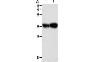 Western Blotting (WB) image for anti-Tropomyosin-2 (TPM2) antibody (ABIN2432365) (TPM2 Antikörper)