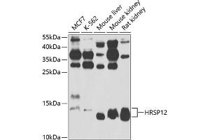 Western blot analysis of extracts of various cell lines, using HRSP12 antibody  at 1:1000 dilution. (HRSP12 Antikörper  (AA 1-137))