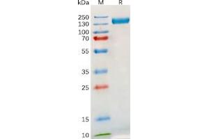 Human TLR3 Protein, hFc Tag on SDS-PAGE under reducing condition.