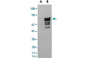 HEK293 overexpressing human PDE4D2 and probed with PDE4D polyclonal antibody  (mock transfection in first lane), tested by Origene. (PDE4D Antikörper  (C-Term))