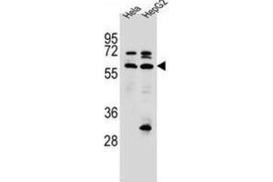 Western Blotting (WB) image for anti-Selenoprotein N, 1 (SEPN1) antibody (ABIN2996755) (SEPN1 Antikörper)