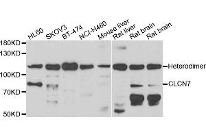 Western blot analysis of extracts of various cell lines, using CLCN7 antibody (ABIN5974147) at 1/1000 dilution.