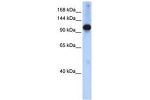 Image no. 1 for anti-SWI/SNF Related, Matrix Associated, Actin Dependent Regulator of Chromatin, Subfamily A-Like 1 (SMARCAL1) (N-Term) antibody (ABIN6742459)