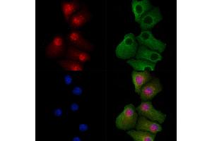 ABIN7094694 and ABIN7098745 staining Hela cells by IF/ICC.