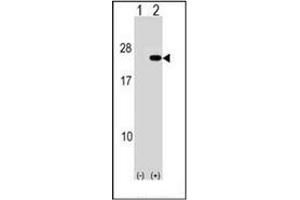 Western blot analysis of PAIP2 (arrow) using PAIP2 Antibody (N-term) Cat.
