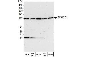 Western Blotting (WB) image for anti-MORC Family CW-Type Zinc Finger 2 (MORC2) (AA 600-700) antibody (ABIN7450930)