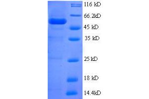 SDS-PAGE (SDS) image for BMI1 Polycomb Ring Finger Oncogene (BMI1) (AA 1-250), (partial) protein (GST tag) (ABIN7479609) (BMI1 Protein (AA 1-250, partial) (GST tag))