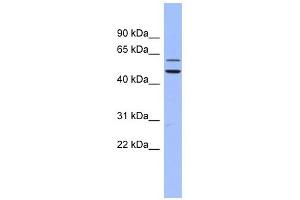 DKC1 antibody used at 1 ug/ml to detect target protein. (DKC1 Antikörper  (N-Term))