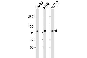 Western Blot at 1:2000 dilution Lane 1: HL-60 whole cell lysate Lane 2: K562 whole cell lysate Lane 3: MCF-7 whole cell lysate Lysates/proteins at 20 ug per lane. (GEN1 Antikörper  (N-Term))