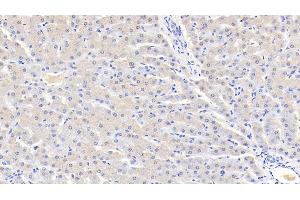 Detection of AT in Bovine Liver Tissue using Polyclonal Antibody to Antithrombin (AT) (SERPINC1 Antikörper  (AA 33-465))