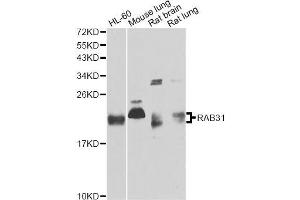Western blot analysis of extracts of various cell lines, using RAB31 antibody (ABIN5995563) at 1/1000 dilution. (RAB31 Antikörper)