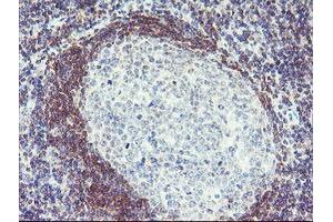 Immunohistochemical staining of paraffin-embedded Human tonsil using anti-PLDN mouse monoclonal antibody. (Pallidin Antikörper)
