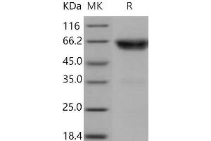Western Blotting (WB) image for Tumor Necrosis Factor Receptor Superfamily, Member 1B (TNFRSF1B) (Active) protein (Fc Tag) (ABIN7320396) (TNFRSF1B Protein (Fc Tag))