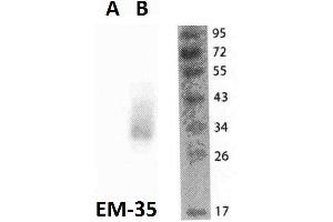 Western blotting analysis of FOLR2 in THP1 cells (A) and FOLR2-transfected THP1 cells (B) using anti-FOLR2 (EM-35) purified. (FOLR2 Antikörper)