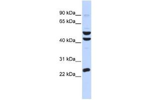 WB Suggested Anti-ZNF200 Antibody Titration:  0. (ZNF200 Antikörper  (Middle Region))