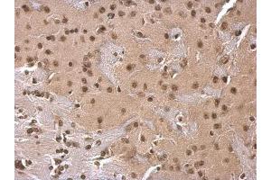 IHC Image SOD1 antibody detects SOD1 protein at cytosol on mouse fore brain by immunohistochemical analysis. (SOD1 Antikörper)