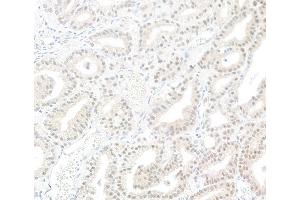 anti-Protein Phosphatase 1, Catalytic Subunit, gamma Isoform (PPP1CC) (C-Term) antibody