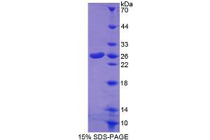 SDS-PAGE analysis of Mouse CORT Protein. (CROT Protein)