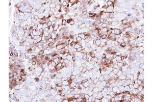 Immunohistochemistry (IHC) image for anti-Purinergic Receptor P2Y, G-Protein Coupled, 13 (P2RY13) (Internal Region) antibody (ABIN2854735)