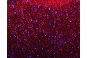 IF analysis of RIMBP2 using anti-RIMBP2 antibody (ABIN7601441). (RIMBP2 Antikörper  (AA 351-1049))