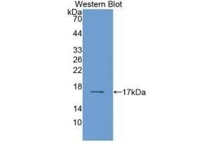 Detection of Recombinant RBP2, Human using Monoclonal Antibody to Retinol Binding Protein 2, Cellular (RBP2) (RBP2 Antikörper  (AA 1-134))