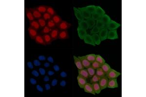 Phospho-MAP3K4 (Ser499) Antibody staining Hela cells(45 min of heat-shock treatment) by IF/ICC.