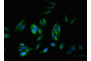 Immunofluorescent analysis of Hela cells using ABIN7171205 at dilution of 1:100 and Alexa Fluor 488-congugated AffiniPure Goat Anti-Rabbit IgG(H+L) (SYNM Antikörper  (AA 1147-1417))