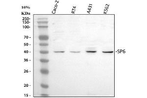 Western blot analysis of SP6 using anti-SP6 antibody (ABIN5692945).