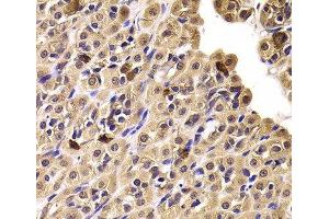 Immunohistochemistry of paraffin-embedded Rat stomach using CCT4 Polyclonal Antibody at dilution of 1:100 (40x lens). (CCT4 Antikörper)