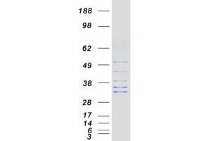 FAM82B Protein (Myc-DYKDDDDK Tag)