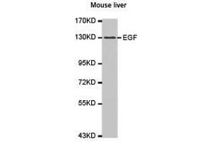 Western Blotting (WB) image for anti-Epidermal Growth Factor (EGF) antibody (ABIN1872450) (EGF Antikörper)