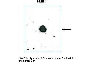 DB Suggested Anti-Nme1 antibody  Titration: 0. (NME1 Antikörper  (C-Term))