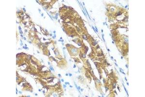 Immunohistochemistry of paraffin-embedded Human stomach using NME3 Polyclonal Antibody at dilution of 1:100 (40x lens). (NME3 Antikörper)