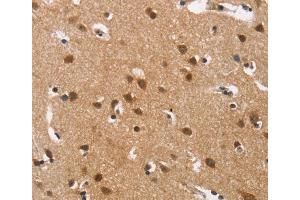 Immunohistochemistry (IHC) image for anti-Calcium Channel, Voltage-Dependent, L Type, alpha 1D Subunit (CACNA1D) antibody (ABIN5549743)