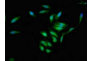 Immunofluorescent analysis of Hela cells using ABIN7157016 at dilution of 1:100 and Alexa Fluor 488-congugated AffiniPure Goat Anti-Rabbit IgG(H+L) (Involucrin Antikörper  (AA 24-118))