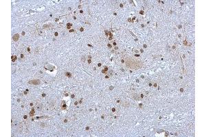 IHC-P Image HMGB1 antibody detects HMGB1 protein at nucleus on rat brain stem by immunohistochemical analysis. (HMGB1 Antikörper)