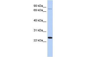 WB Suggested Anti-RPS7 Antibody Titration: 0.