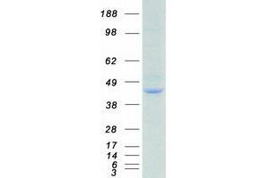 Western Blotting (WB) image for Guanine Nucleotide Binding Protein (G Protein), Q Polypeptide (GNAQ) protein (Myc-DYKDDDDK Tag) (ABIN2721499)