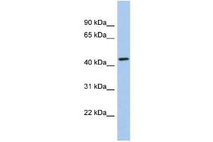 WB Suggested Anti-KCTD10 Antibody Titration:  0. (KCTD10 Antikörper  (Middle Region))
